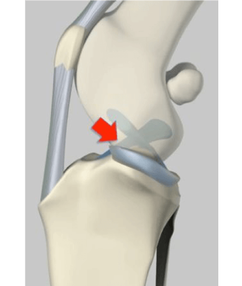 Cranial Cruciate Ligament