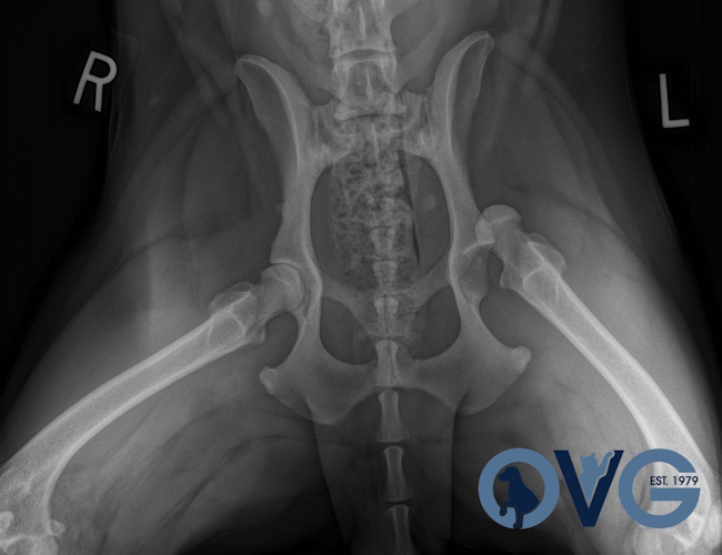 Hip dislocation