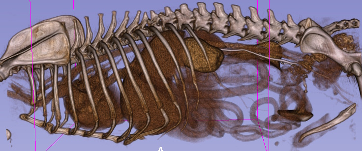 CT Scan of a cystic kidney