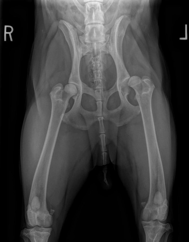 Hip Dysplasia