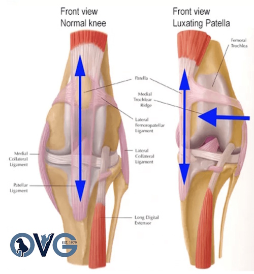 Diagram of a Patella Luxation
