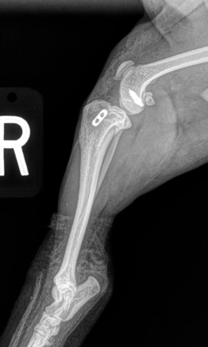 Post surgical view of FASTak