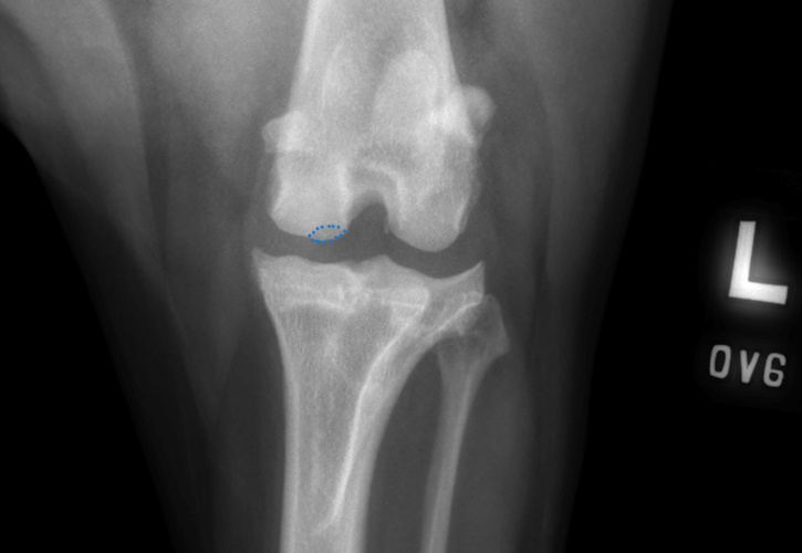 Stifle Osteochondritis dissecans (OCD) highlighted in a dog