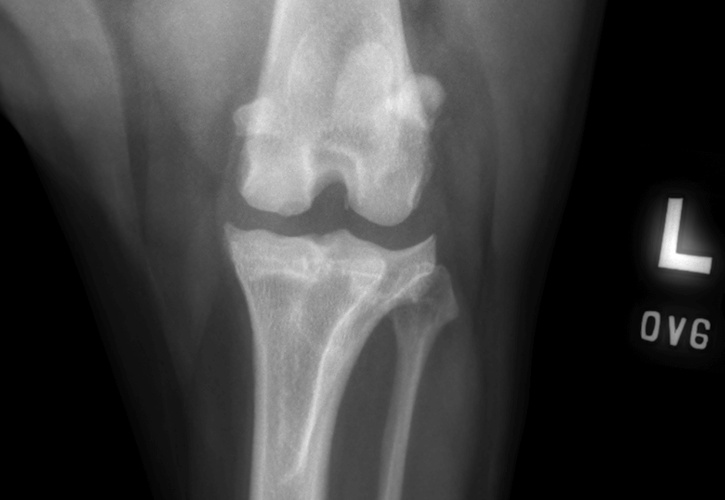 Stifle Osteochondritis dissecans (OCD) in a dog