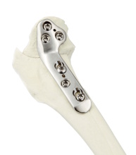 Visual of a TPLO corrective osteotomy