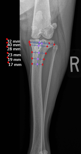 Radiograph of the front of the knee