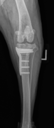 Radiograph assessing screw size and appropriate position